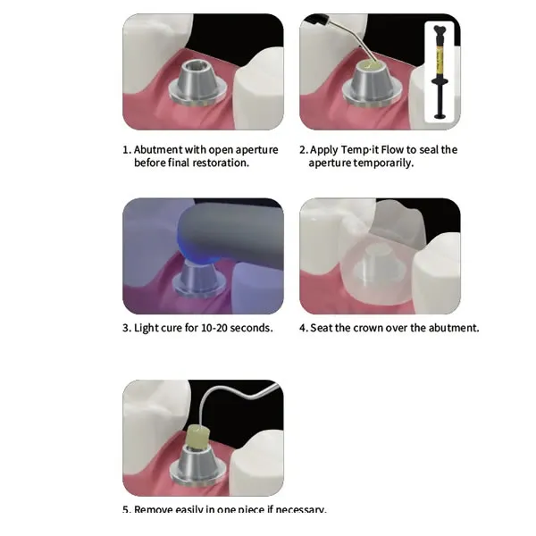 Cemento obturador Temp IT - Spident 2 Cemento obturador Temp IT - Spident - Imagen 2