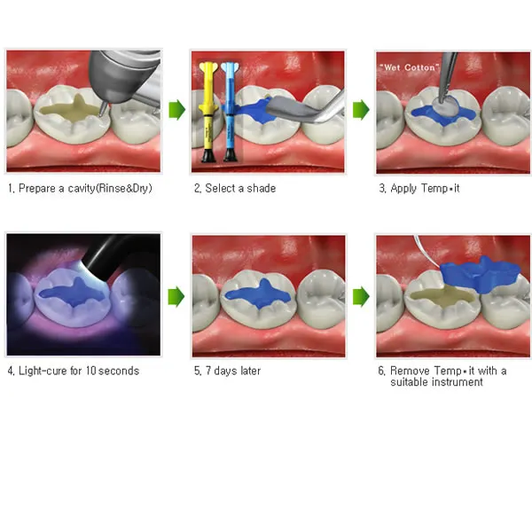 Cemento obturador Temp IT - Spident 4 Cemento obturador Temp IT - Spident - Imagen 4