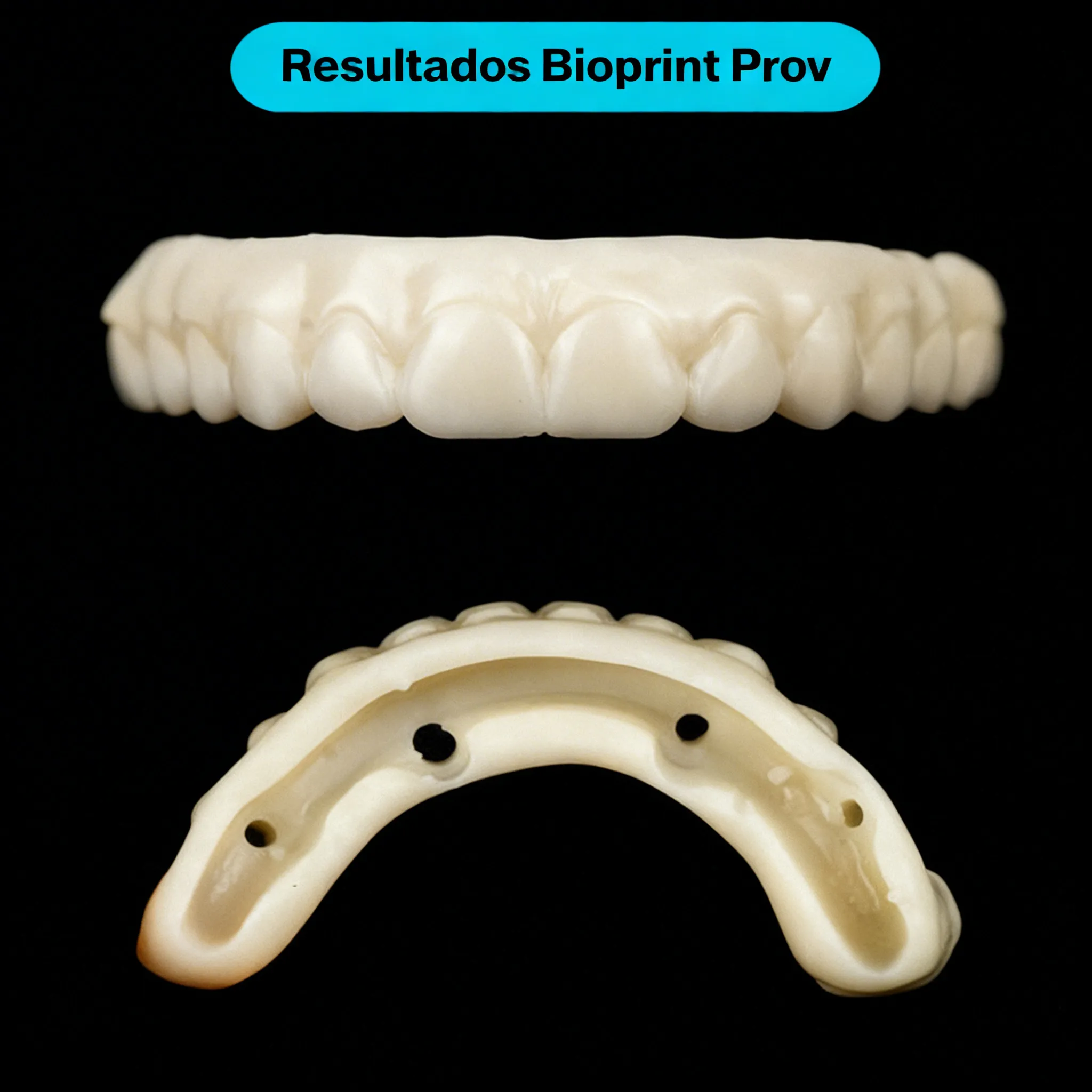Resinas 3D provisional dental - Prov - Horus 3 Resinas 3D provisional