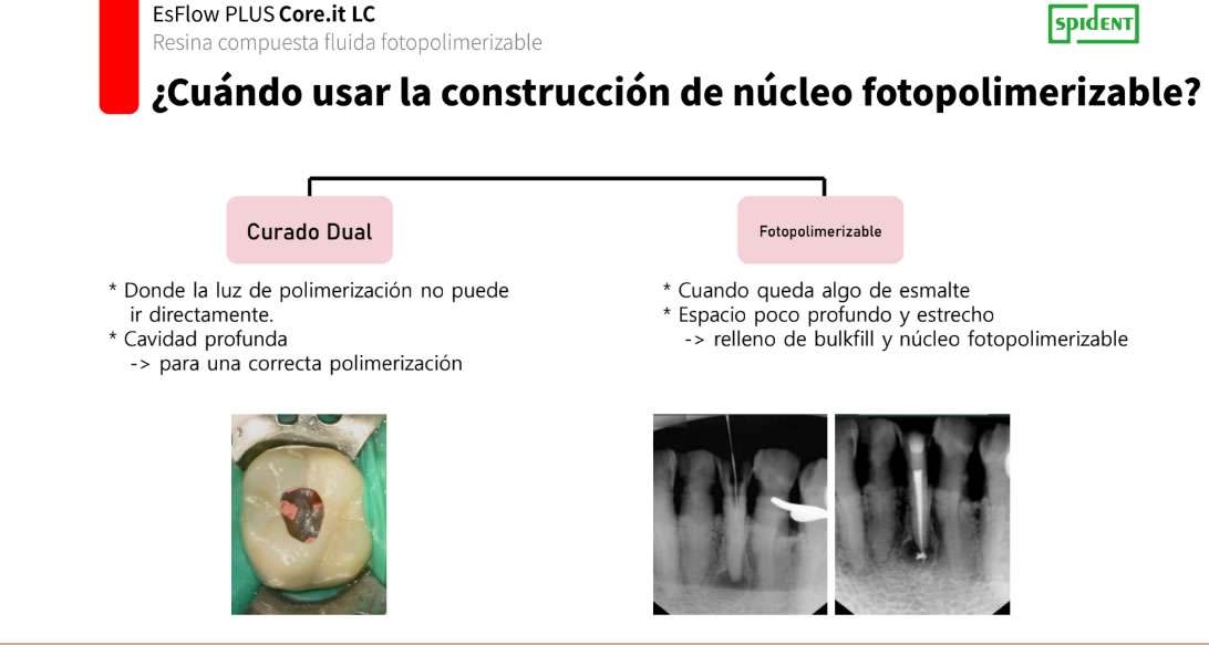 EsFlow Plus Core It Reconstructor de muñones fluido - Spident 5 EsFlow Plus Core It Reconstructor de muñones fluido - Spident - Imagen 5