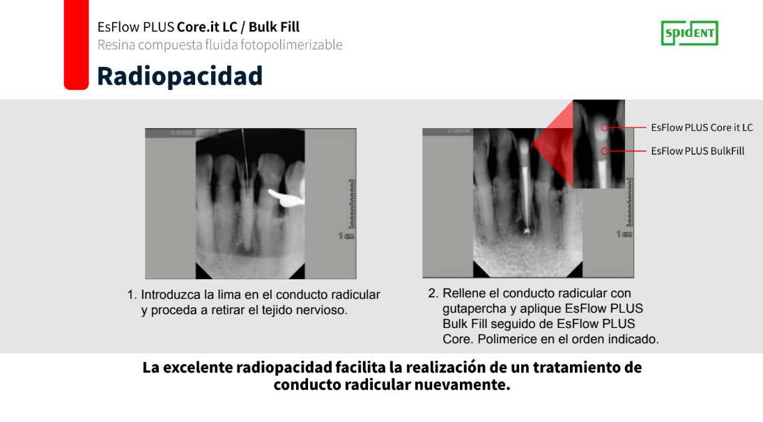 EsFlow Plus Core It Reconstructor de muñones fluido - Spident 2 EsFlow Plus Core It Reconstructor de muñones fluido - Spident - Imagen 2