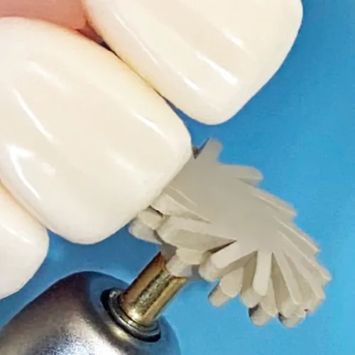 Discos Espirales para Pulido y Brillo de Resinas | Goodent 4 pulidores para resina dental suppra diamantados
